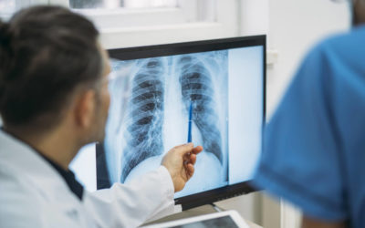 3 mitos e verdades sobre a fibrose pulmonar