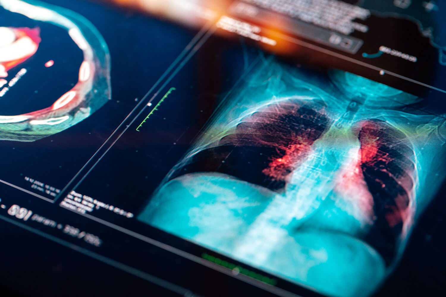 Sequelas da covid para o sistema respiratório