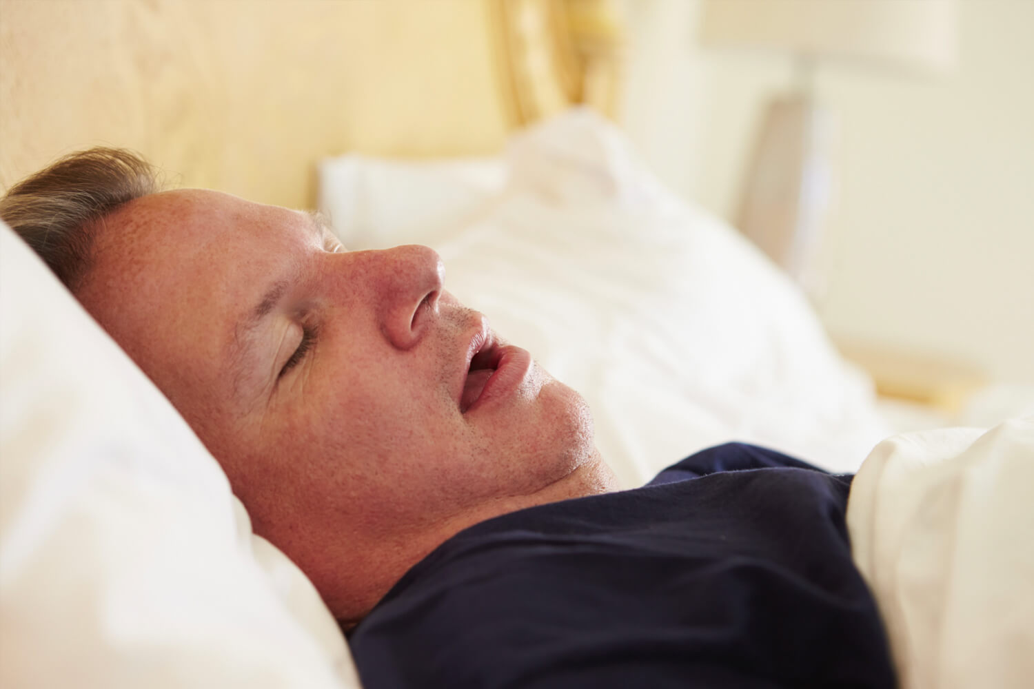 ronco e ganho de peso ronco e ganho de peso