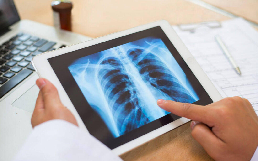 Pneumologia: entenda a especialidade médica